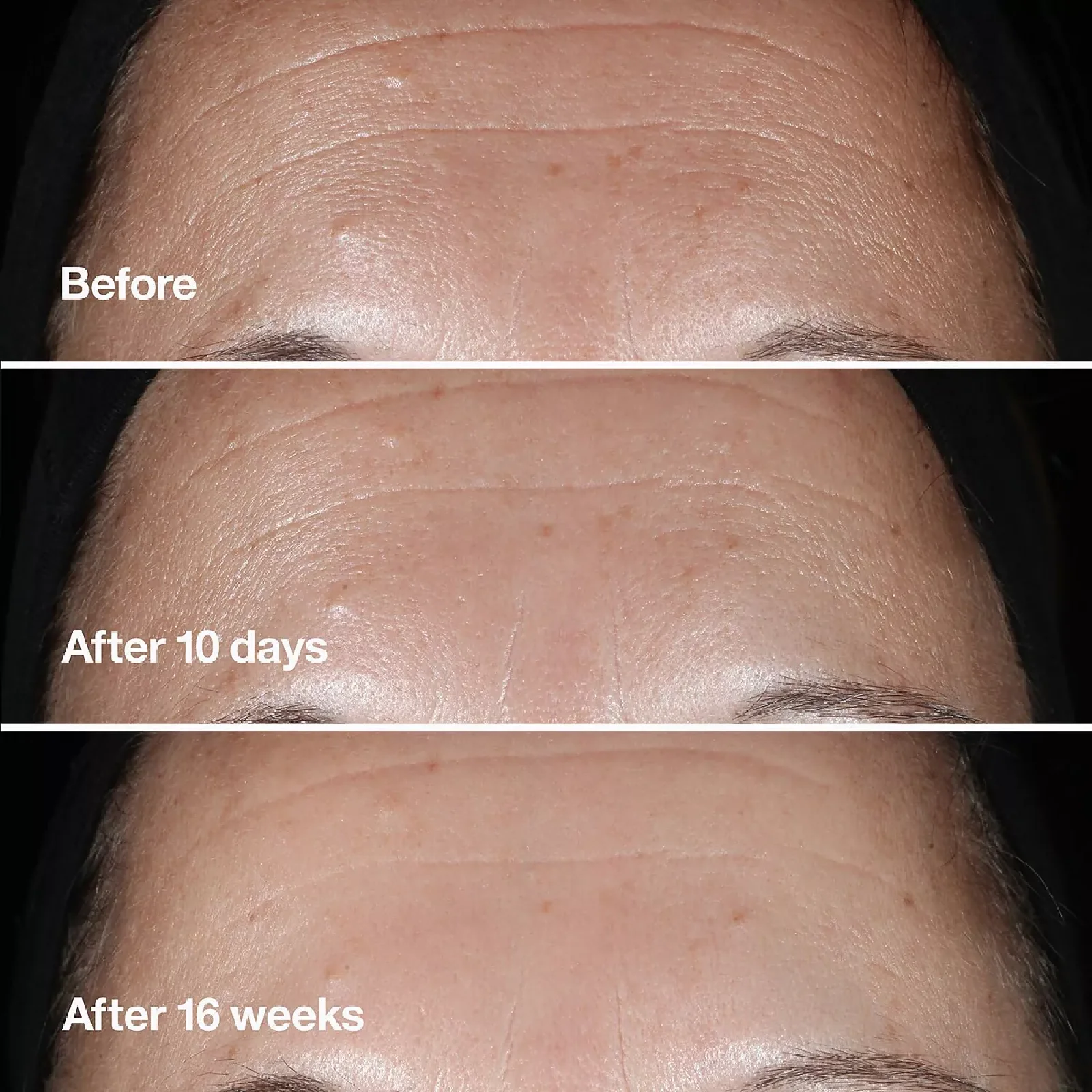 Clinique Smart Clinical Repair Wrinkle Correcting Serum - Image 4