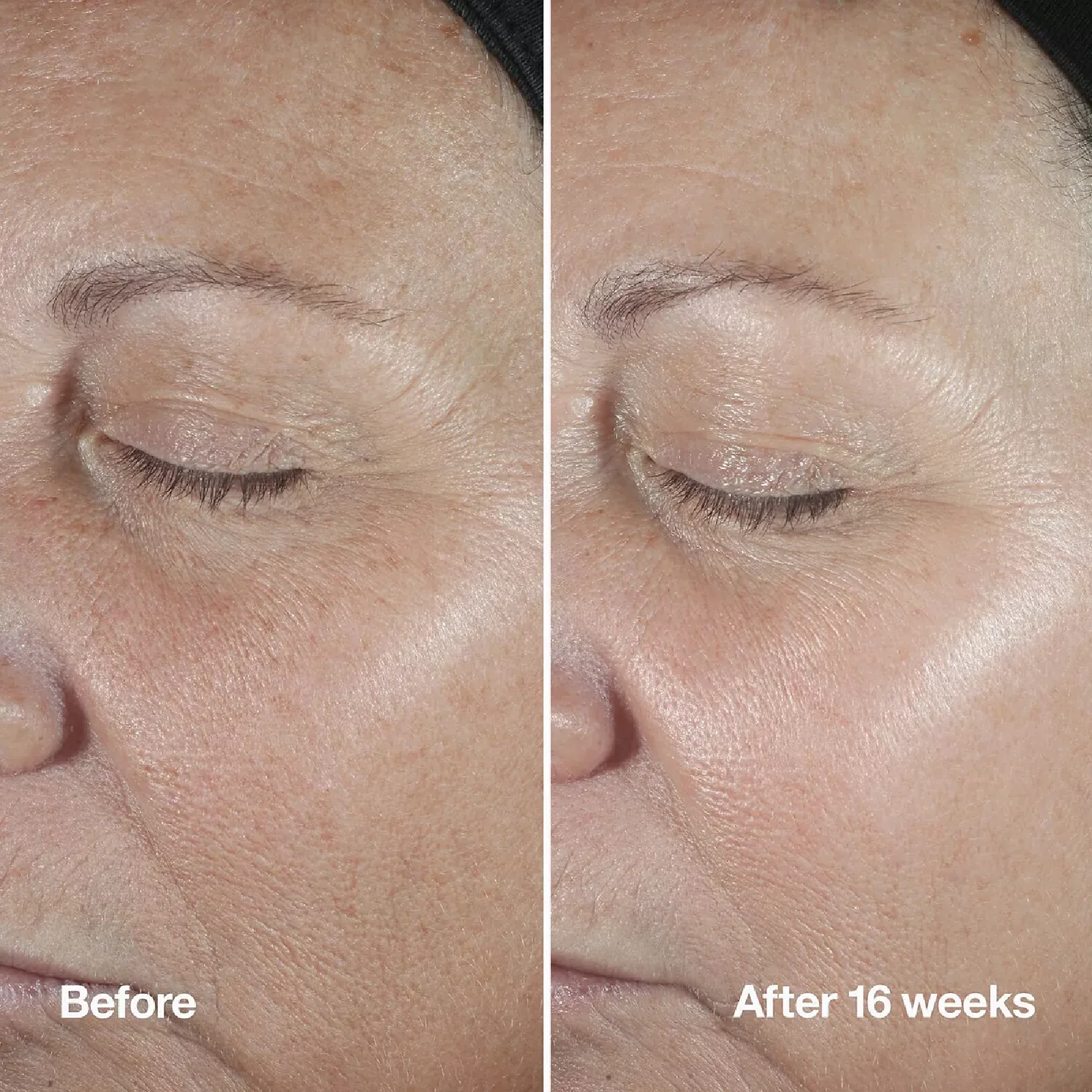 Clinique Smart Clinical Repair Wrinkle Correcting Serum - Image 5