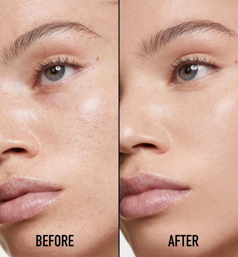 Dior Forever Skin Correct Full-Coverage Concealer - Image 8
